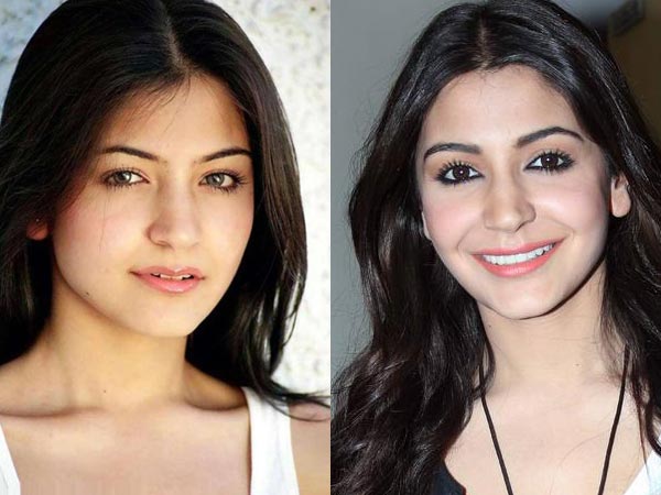 Anushka Sharma Angry Over Rumoured Plastic Surgery Reports